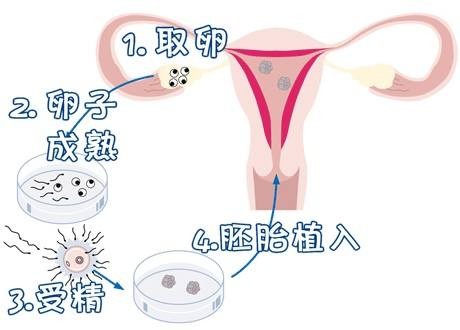 关于代怀供卵自怀医院